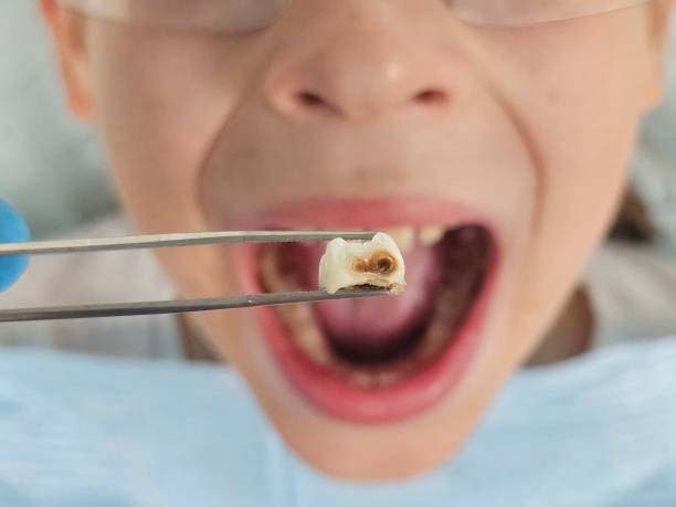 Trusted CA Emergency Dental Service Experts